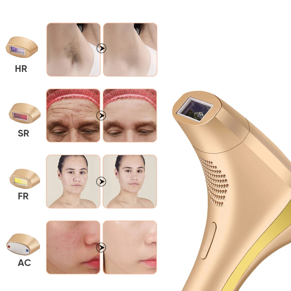 Dames IPL Laser Ontharingsapparaat 4-in-1 voor Gezicht en Lichaam 1
