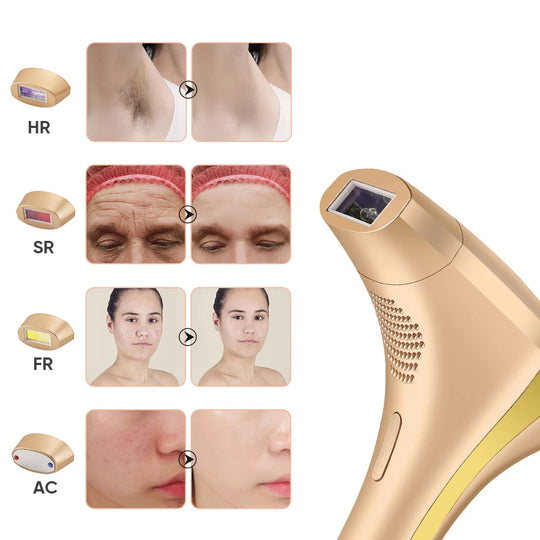 Dames IPL Laser Ontharingsapparaat 4-in-1 voor Gezicht en Lichaam 1